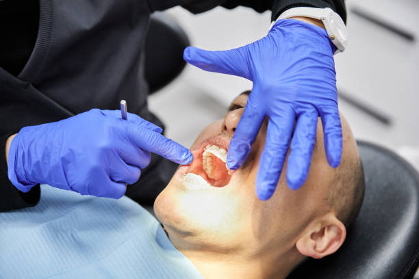 Best Emergency Treatment for Dental Infections or Abscesses in Country Clu, CA