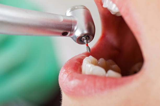 Best Same-Day Emergency Dental Services in Country Clu, CA